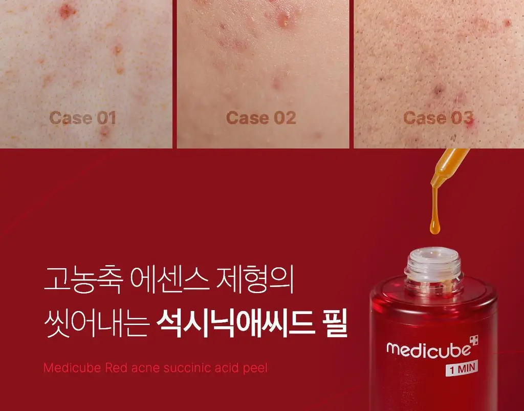 [NEW/여드름성 피부 완화 기능성] 메디큐브 레드 아크네 석시닉 애씨드 필 40g 상세페이지 3